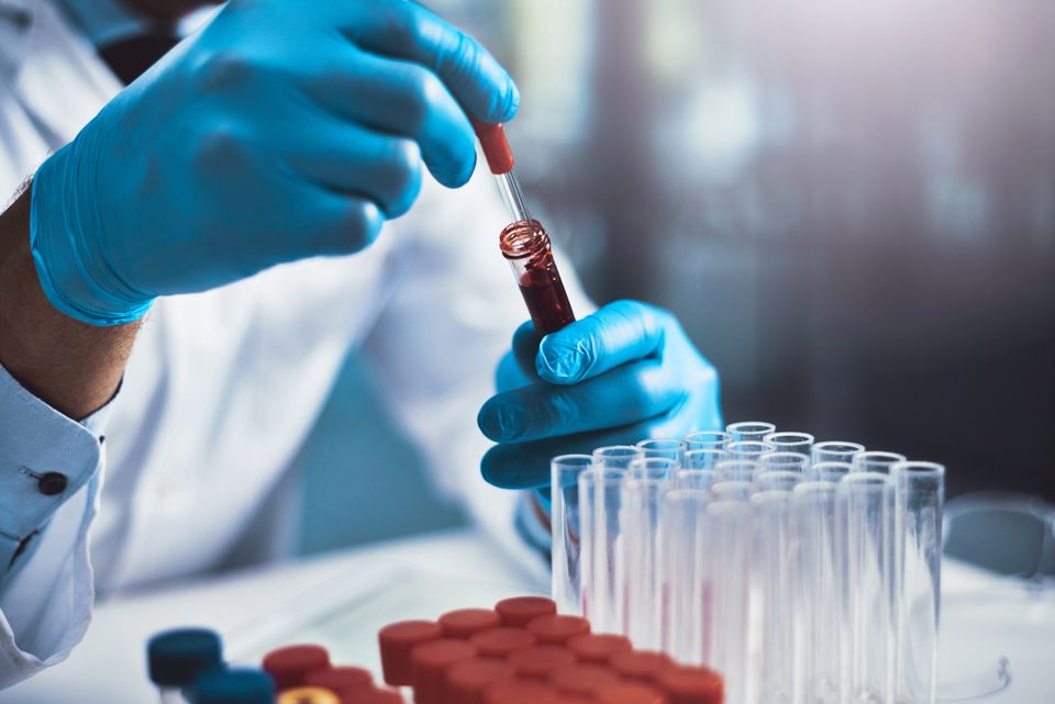 94 fik hiv-diagnose i Danmark – omkring halvdelen blev opdaget sent